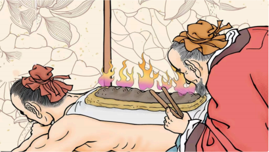 中醫(yī)特色療法：“灸中之王”——督灸